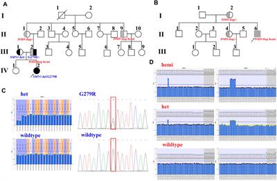 Long-Read Sequencing Revealed Extragenic and Intragenic Duplications of Exons 56–61 in DMD in an Asymptomatic Male and a DMD Patient